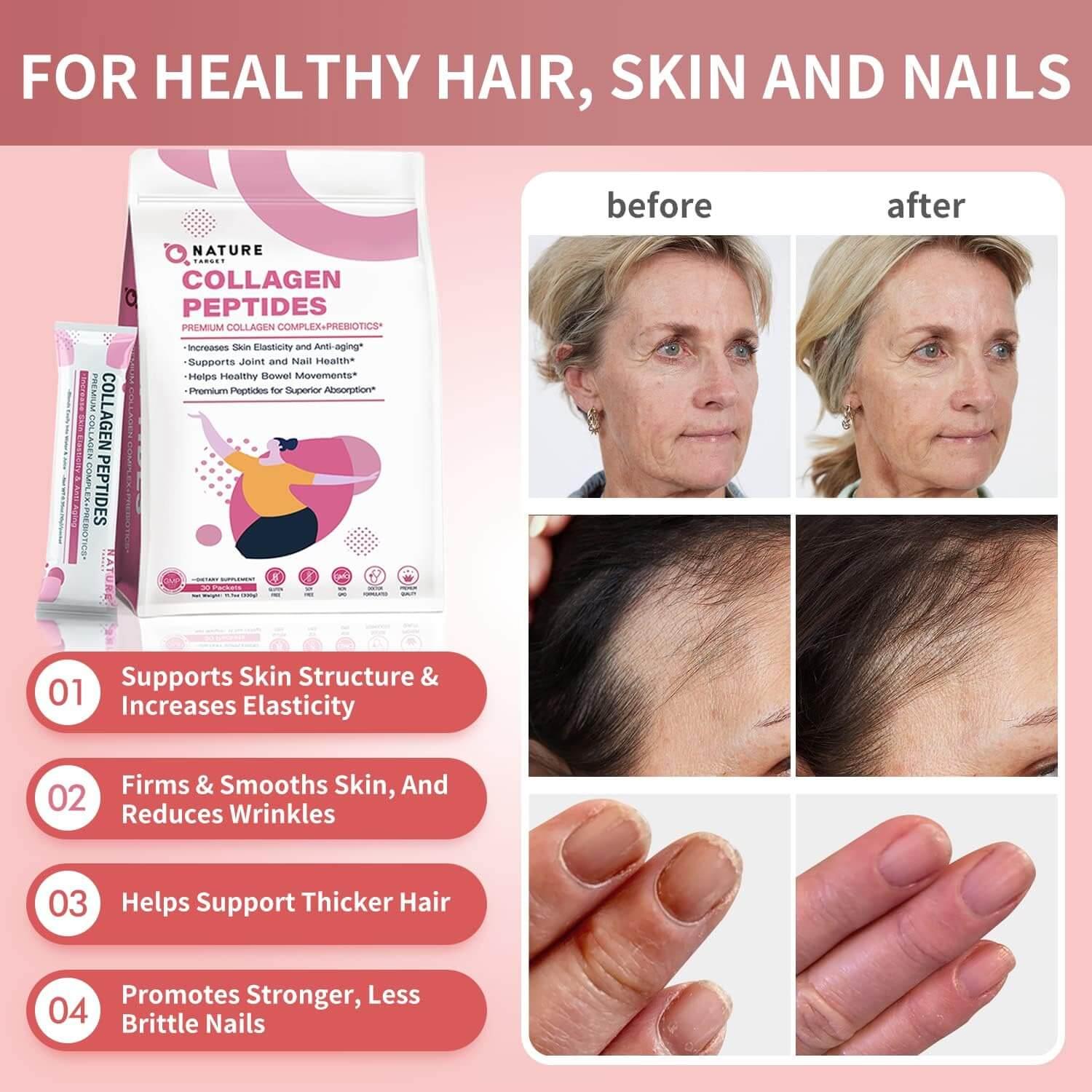 Collagen peptides packaging with before and after effects on skin and hair on a pink background