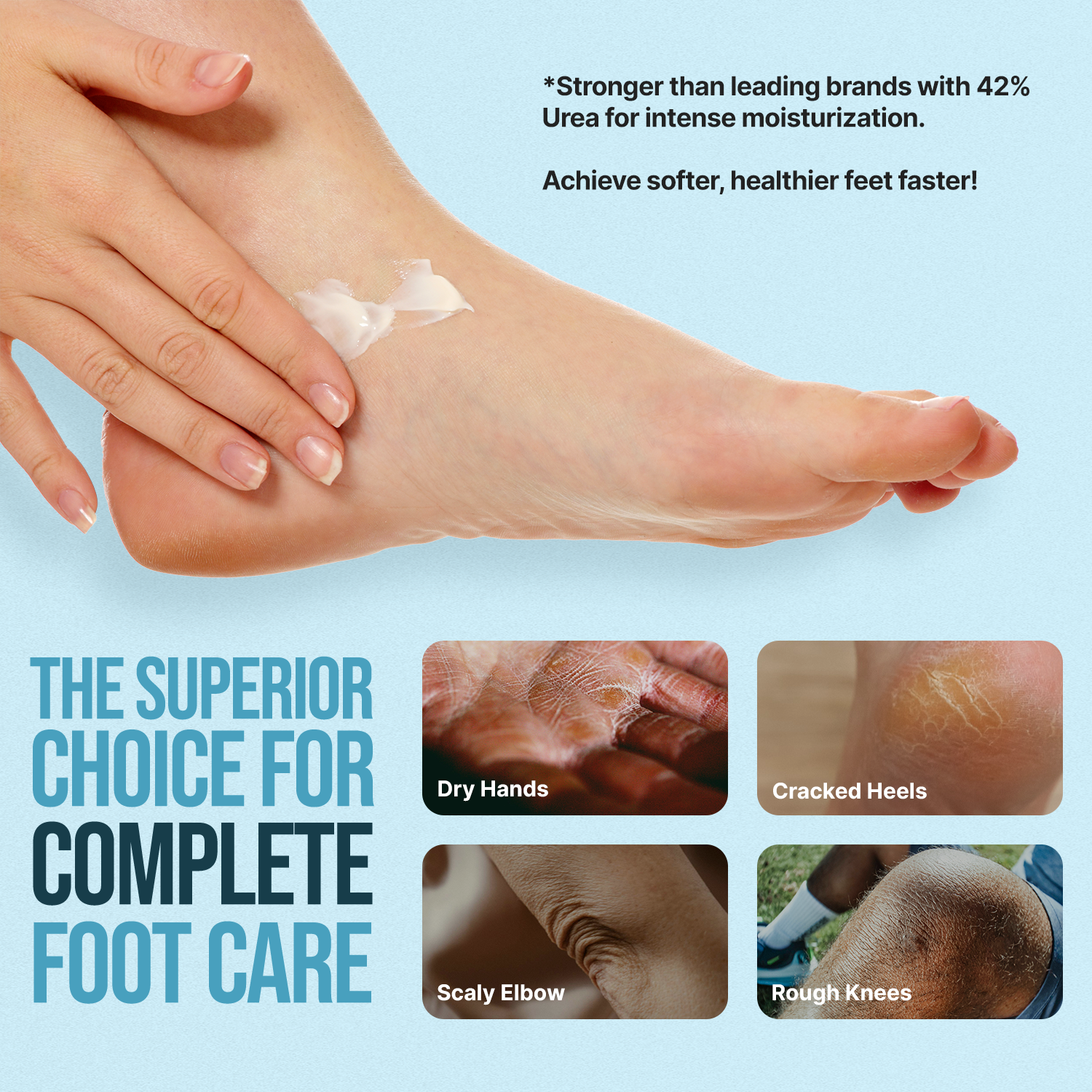 Hand applying cream to a foot with text about product strength and benefits on a light blue background.