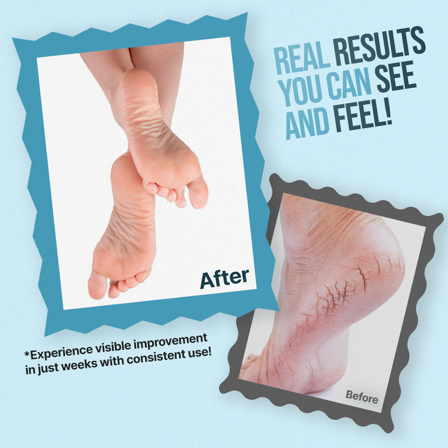 Before and after comparison of a foot with visible improvement, on a light blue background.