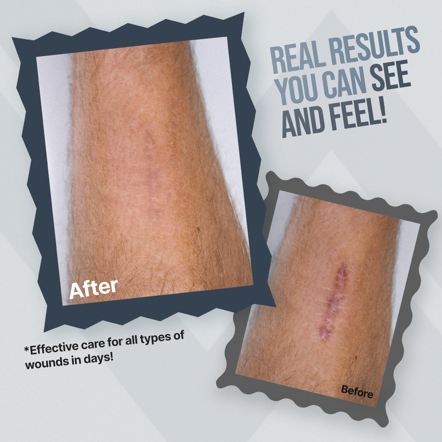 Before and after comparison of a wound with text about effective care for wounds.