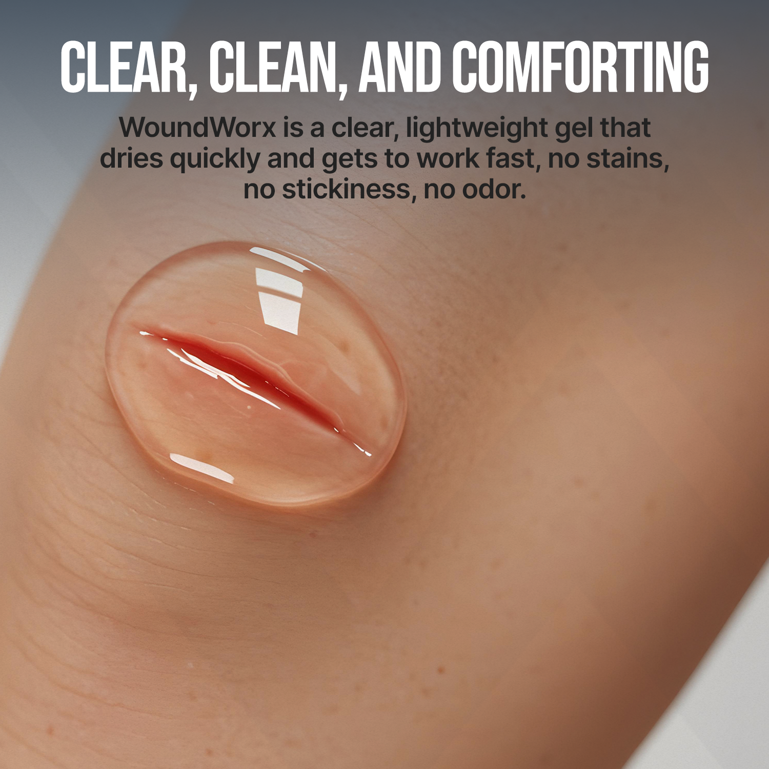 WoundWorx gel applied to skin with text describing its properties.